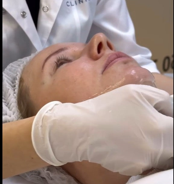 10 Surprising Benefits of Mesotherapy