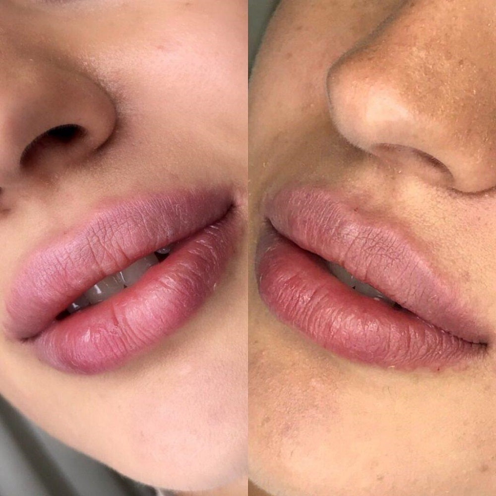 Lips