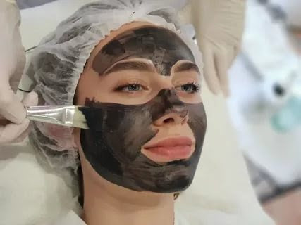 Carbon Peel